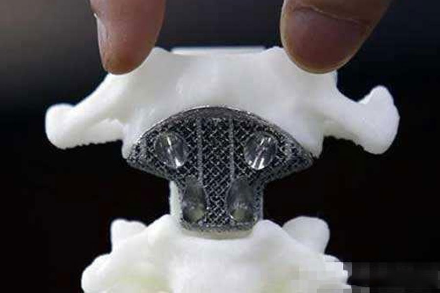 3D printed bone model